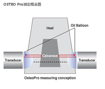 osteopro测定概念图